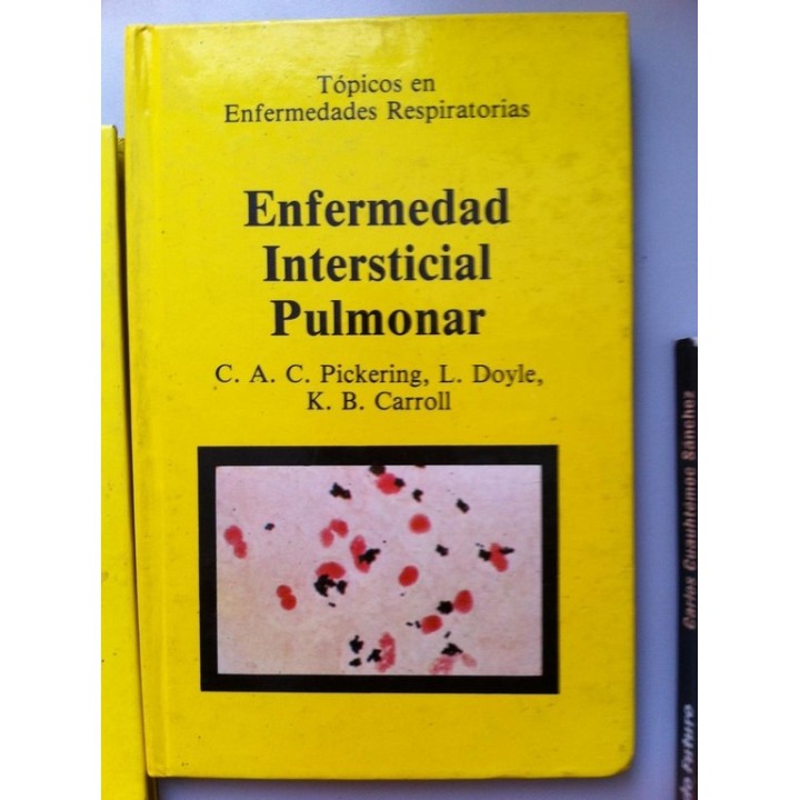 TOPICOS EN ENFERMEDADES RESPIRATORIAS. Enfermedad Intersticial Pulmonar